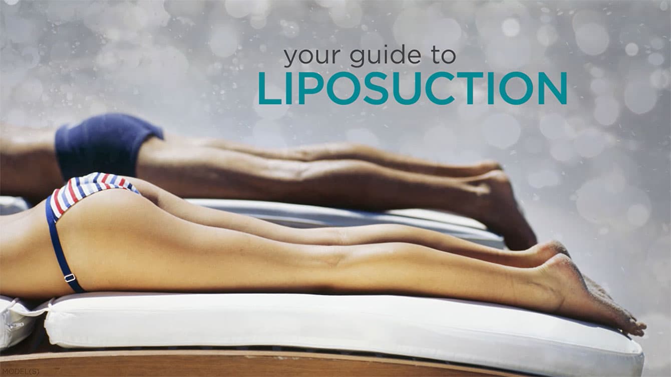 Your Guide to Liposuction video thumbnail