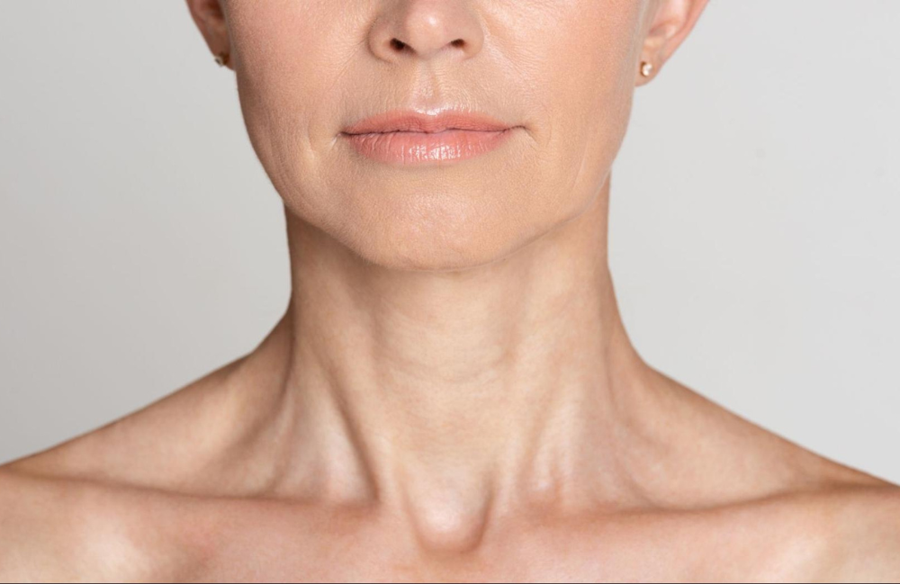 Redefining Youth: Botox® for Platysmal Bands